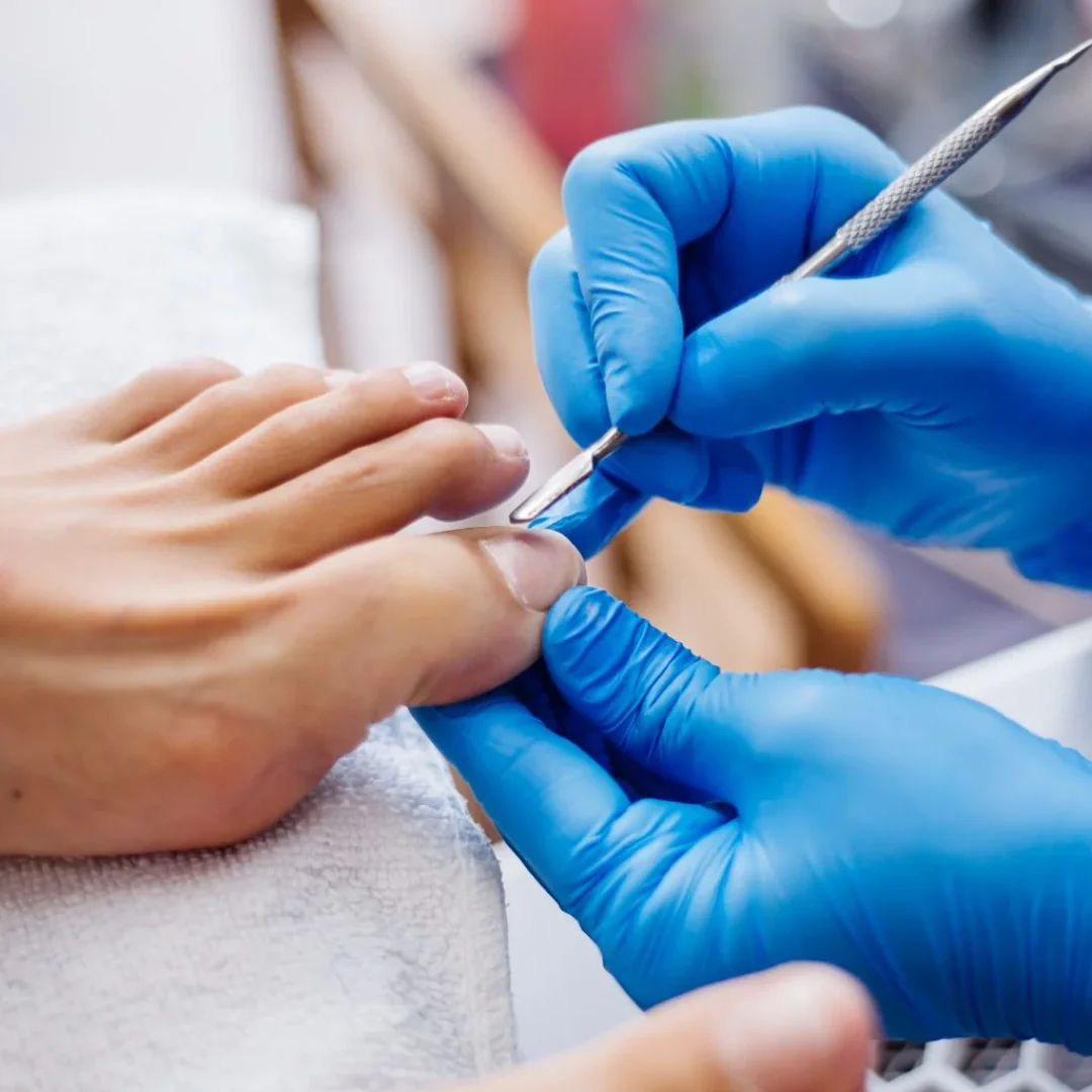 Profissional realizando um procedimento de podoprofilaxia